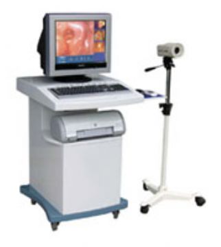 Video Colposcope Camera